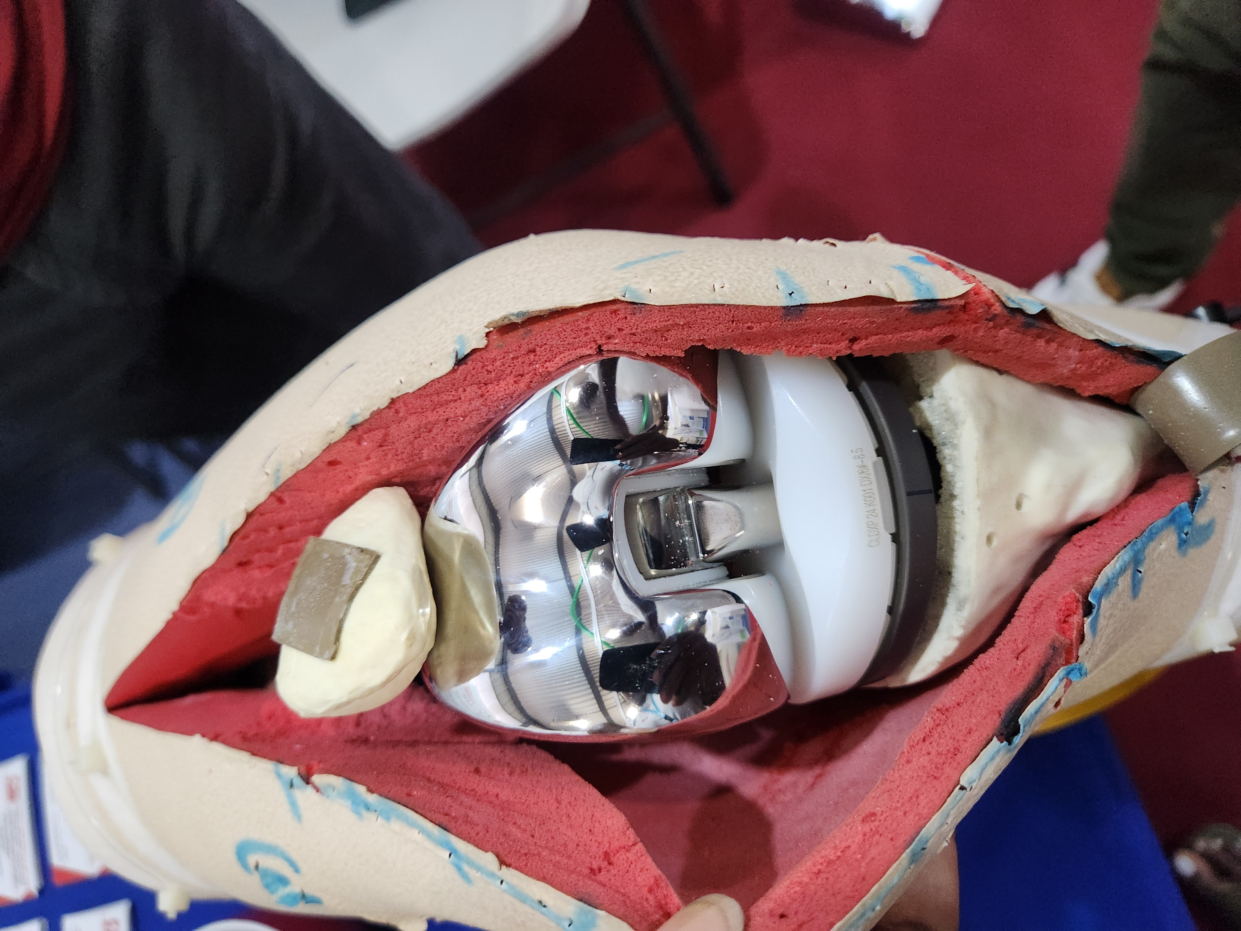 Prothèse de genou — démonstration